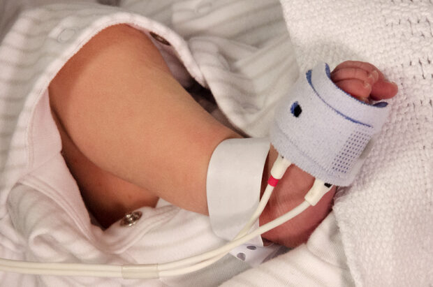 A newborn baby's foot with equipment attached to it.