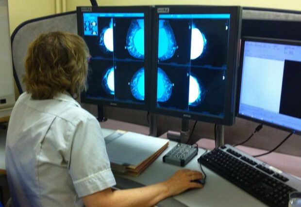 A health professional reviewing mammograms on a computer screen