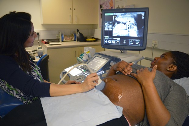A woman looking at a photo of her baby on screen as she is having an ultrasound scan taken