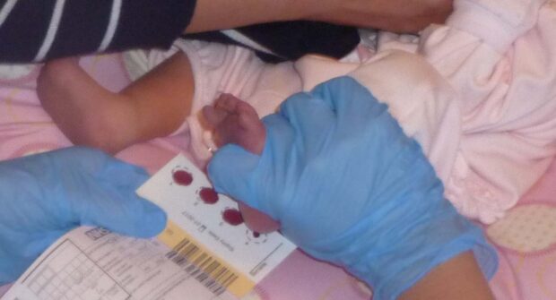 blood spot test being taken from a baby's foot