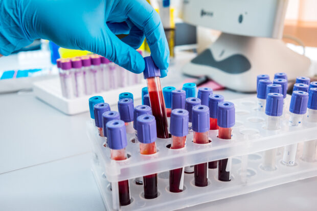 Laboratory blood samples.