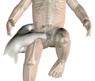 Part of an animation, showing a newborn baby having its hips tested