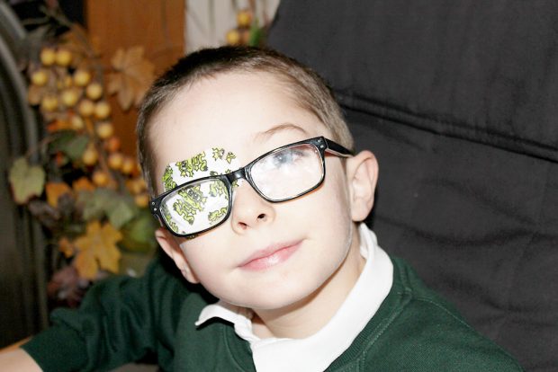 Cameron wearing his eye patch and glasses.