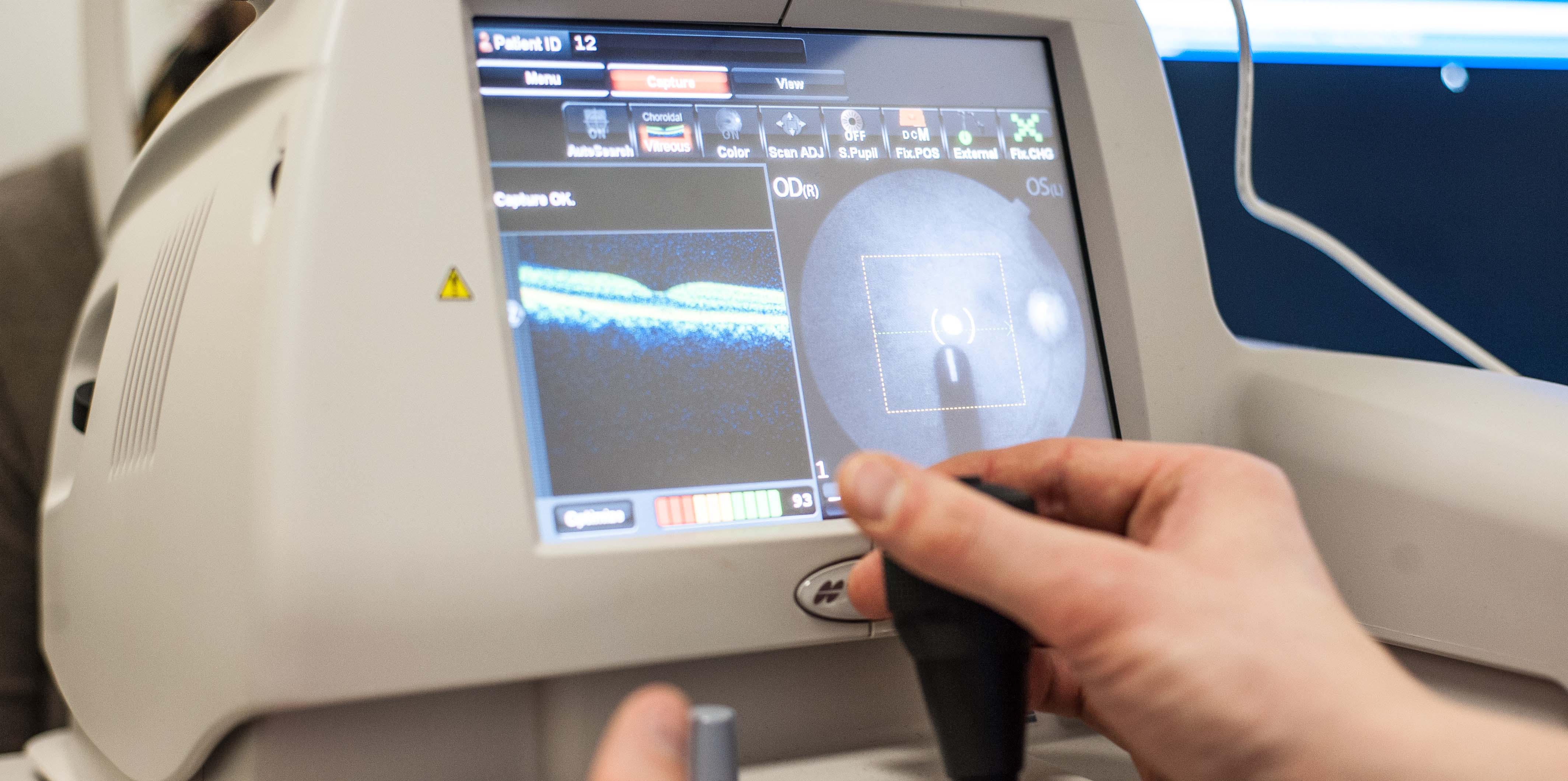 Diabetic eye screening data extraction system reaches 1 million