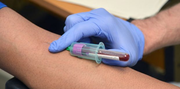 Blood sample is taken from an arm.