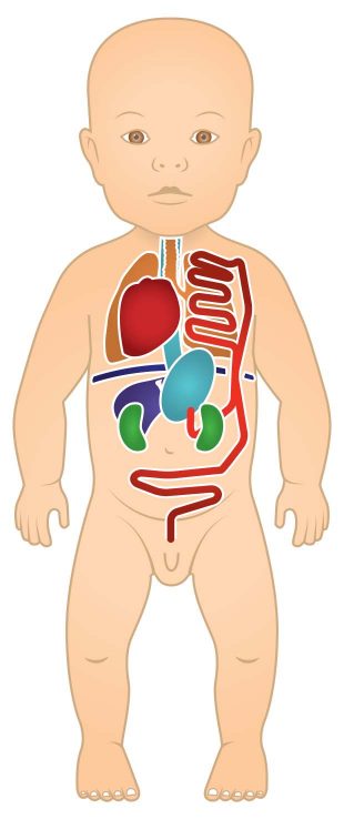 diaphragmatic hernia illustration