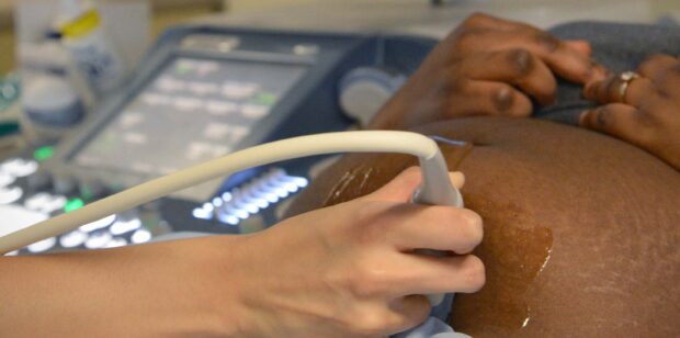 A close-up of a pregnant woman having an ultrasound scan.