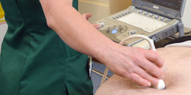 An ultrasound scan is being undertaken in the AAA screening programme.