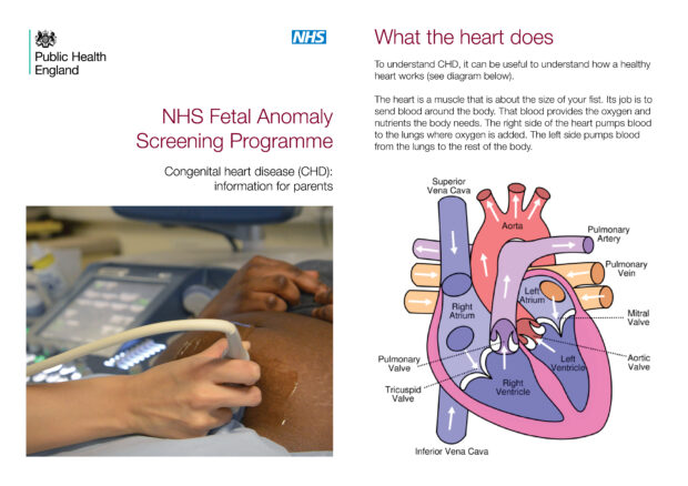 Front cover and page 3 of the NHS fetal anomaly screening programme congenital heart disease information leaflet for patients