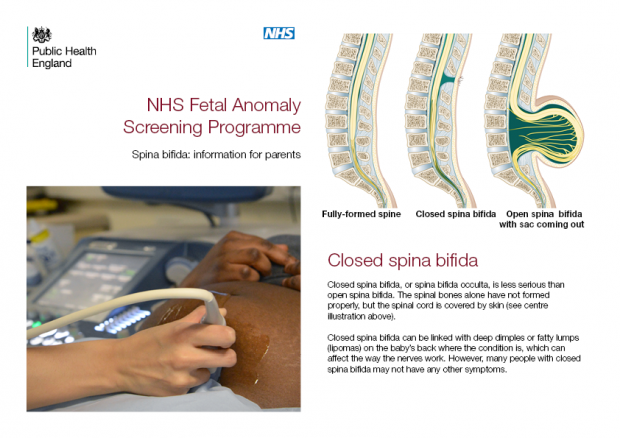 The front cover and page 3 of the new spina bifida information leaflet for parents