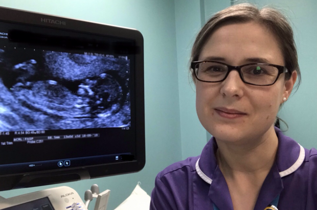 Midwife sonographer Lisa McNulty in front of a screen showing an ultrasound image