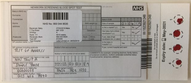 A blood spot card showing a poor quality sample because the 4 blood spot samples are too small.