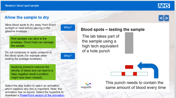 A blood spot card showing a poor quality sample because the 4 blood spot samples are too small.