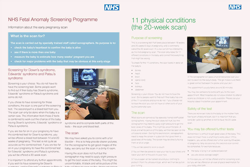 Antenatal ultrasound scan information sheets updated - PHE Screening