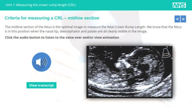A screenshot from Unit 1 of the e-learning resource which shows a fetus and the words 'criteria for measuring a crown rump length - midline section'.