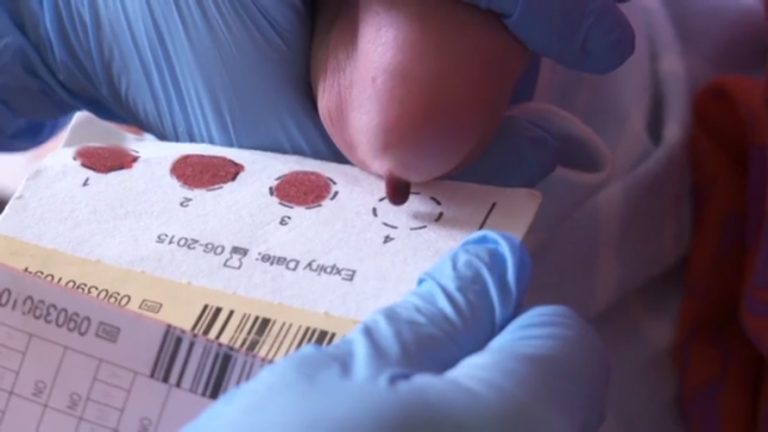 Newborn Blood Spot Evaluation Update — Screening For Scid Phe Screening