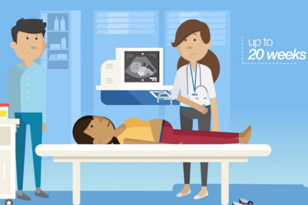 A screenshot of PHE's animation on Screening tests for you and your baby. A woman is having an ultrasound scan taken.