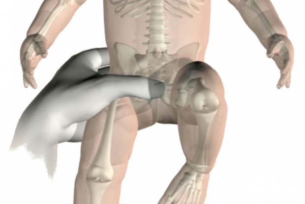 Anatomical illustration of hip examination as part of newborn screening 