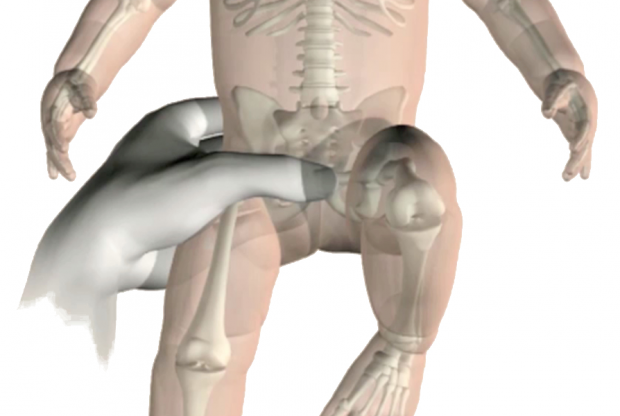 Anatomical illustration of hip examination as part of newborn screening