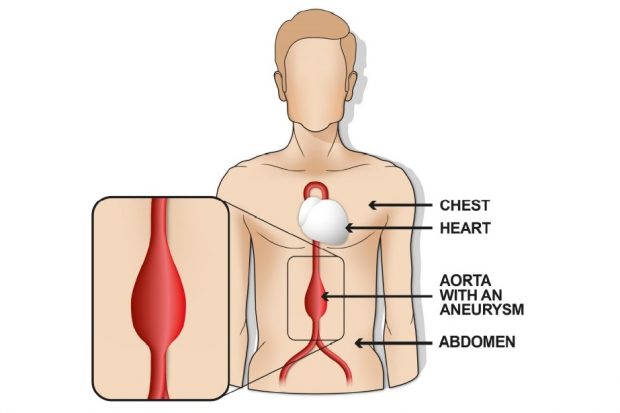 Images are taken of the aorta to check for swelling