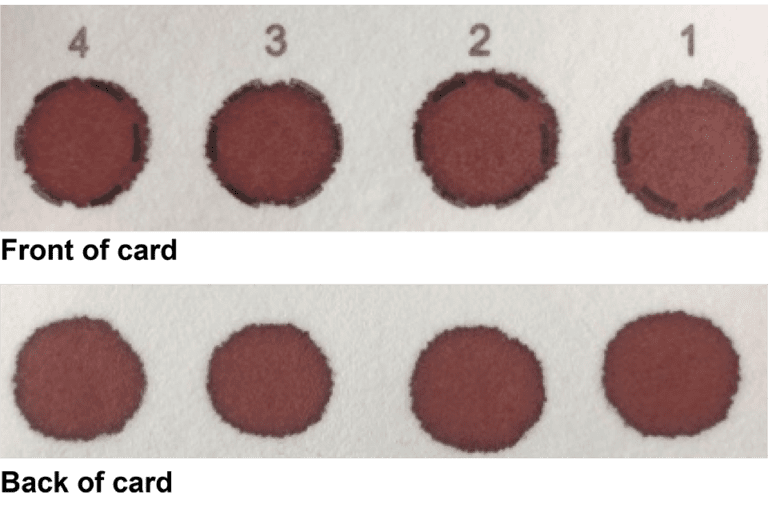 New Resources To Help Improve Quality Of Samples Taken In NHS Newborn 